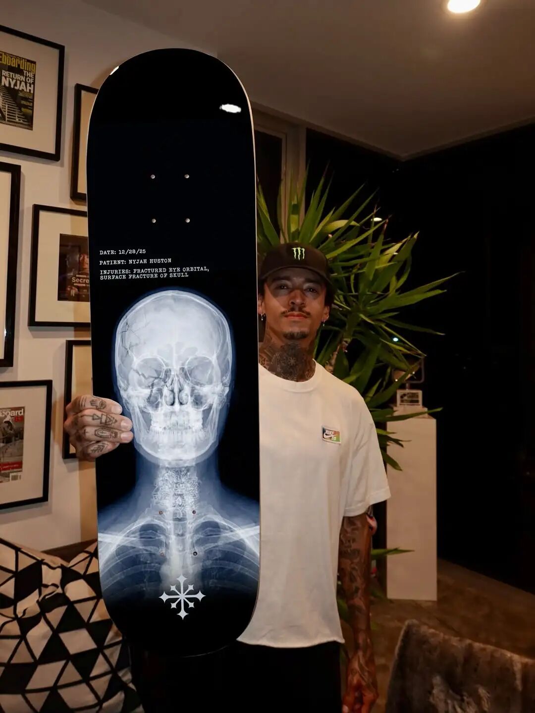 摔裂头骨后劝人戴头盔，自己却坚持不戴: Nyjah为何如此"双标"？-MadFuture 疯未来