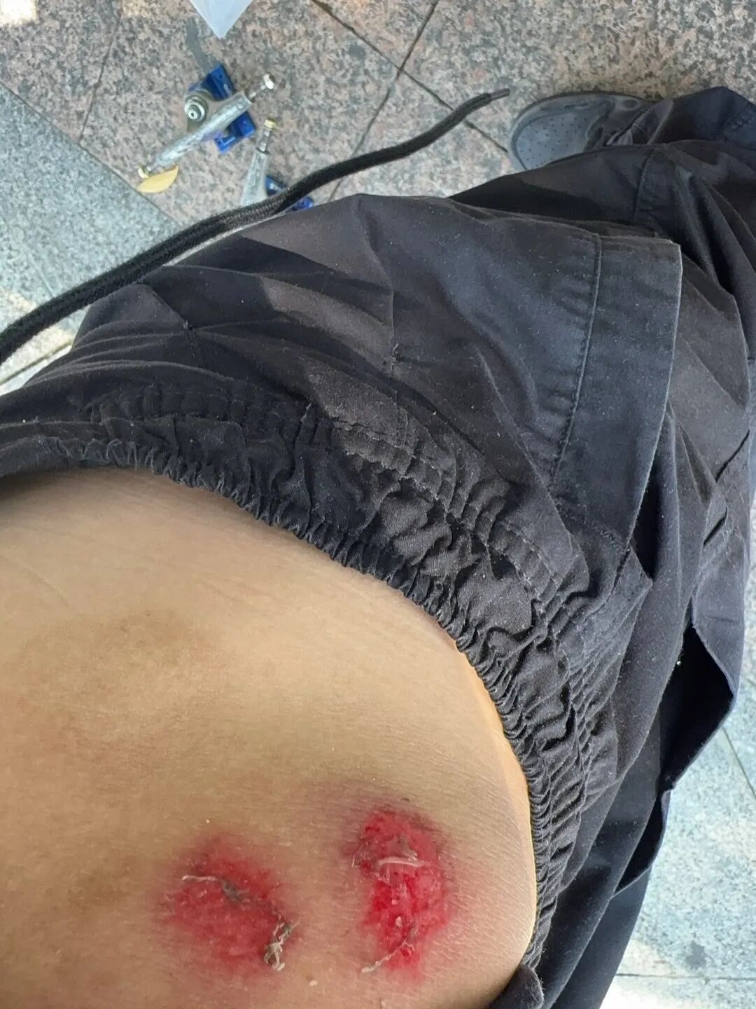 专访第十五届全运会男子街式冠军: 潘家杰！-MadFuture 疯未来